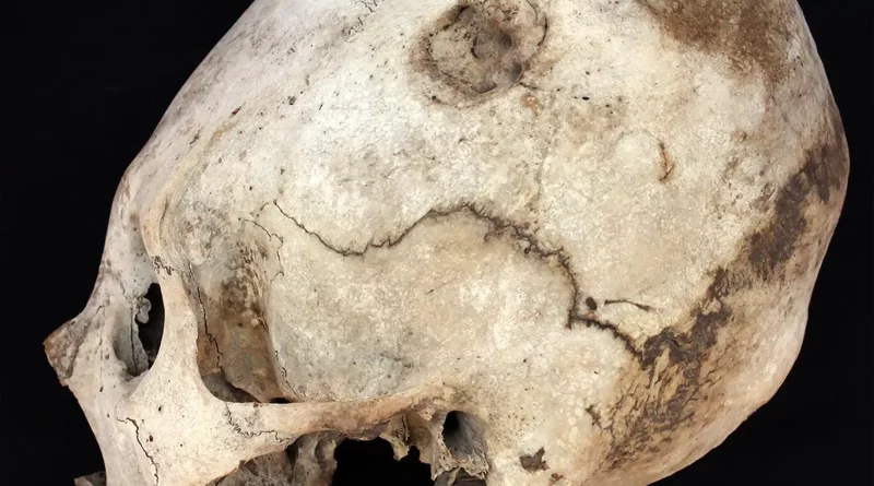 WAS HEAD- BINDING AN ANCIENT WAY TO GET A LEG UP?