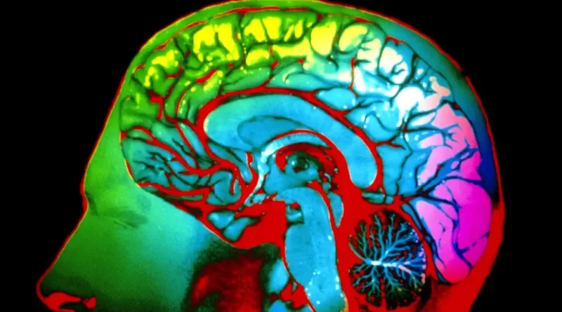 DO YOU SEE THE SAME COLORS THAT I DO?