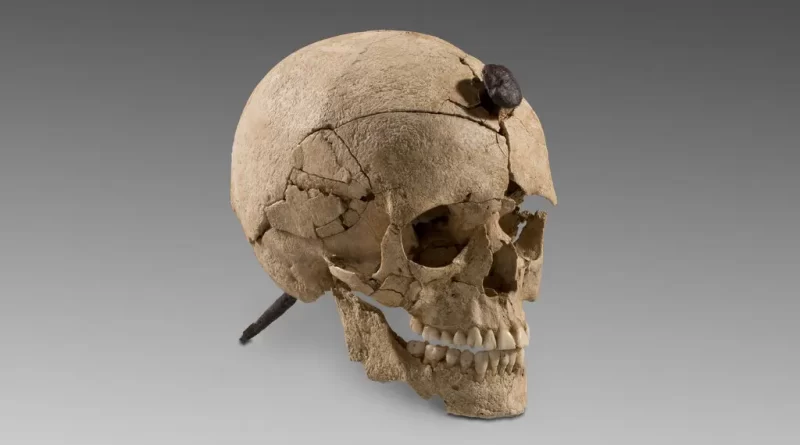 In Ancient Spain, a Nail Through the Skull Could Mean Enmity, or Honor