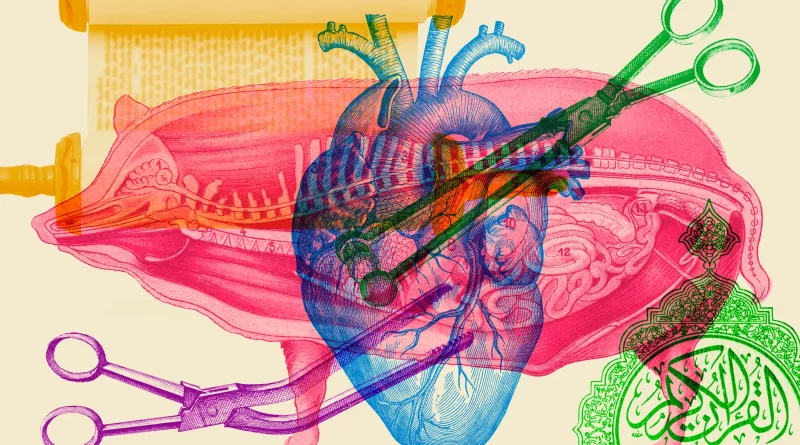 चीनी सर्जनों ने किया दुनिया का पहला सूअर से इंसान का लिवर प्रत्यारोपण