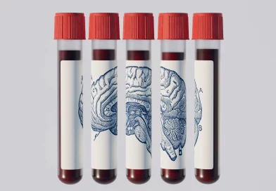 क्या एक रक्त परीक्षण बता सकता है कि आपको अल्जाइमर होगा? क्या एक रक्त परीक्षण बता सकता है कि आपको अल्जाइमर होगा?