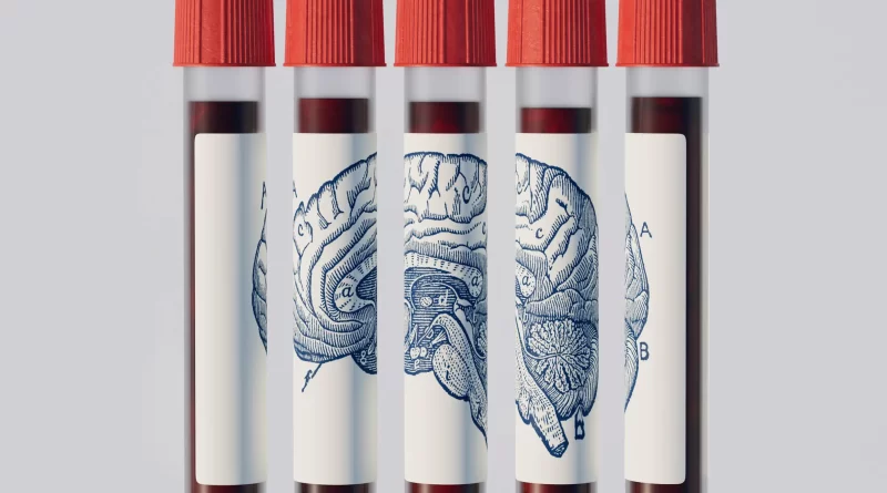 क्या एक रक्त परीक्षण बता सकता है कि आपको अल्जाइमर होगा?