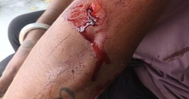 रौता ग्राम पंचायत में दिनदहाड़े गुलदार का हमला, युवक घायल,  ग्रामीणों में दहशत