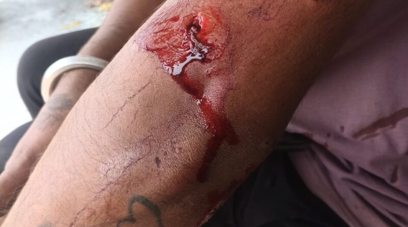 रौता ग्राम पंचायत में दिनदहाड़े गुलदार का हमला, युवक घायल,  ग्रामीणों में दहशत