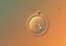 Scientists Edit Human Embryo Genes With Startling Precision Scientists Edit Human Embryo Genes With Startling Precision