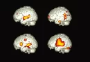 How Does One Brain Speak Two Languages?