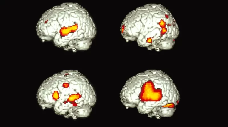 How Does One Brain Speak Two Languages?