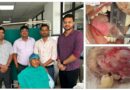 साढ़े तीन घंटे की सर्जरी में 97 ग्राम का दुर्लभ ओडोन्टोमा निकाला, किशोर को लौटाई मुस्कान