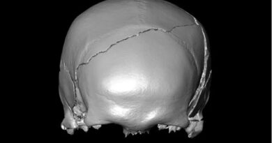 A 14th-Century Skeleton Had Injuries That Looked Like a Car Crash. What Killed Him?