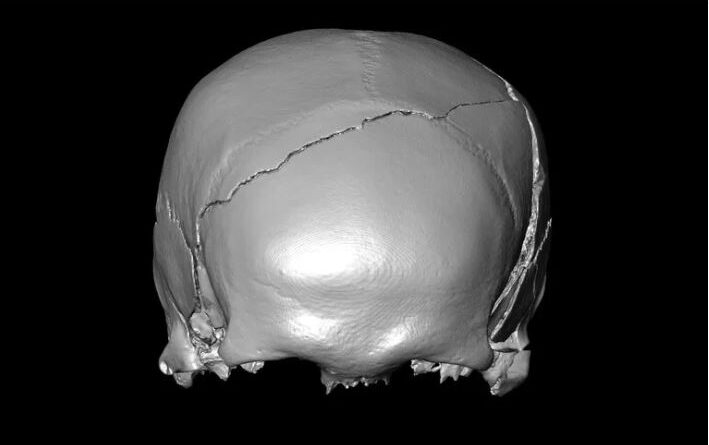 A 14th-Century Skeleton Had Injuries That Looked Like a Car Crash. What Killed Him?