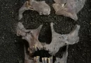 Scientists Discover the Earliest Evidence of Drug Use in Really Old Teeth