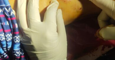 पहाड़ में बढ़ता बंदरों का आतंक, घर में घुसकर पूर्व प्रधान को किया गंभीर घायल