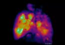 These Mice Have Partly Human Brains