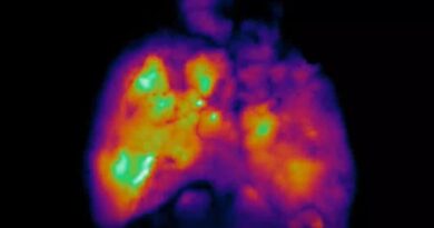 These Mice Have Partly Human Brains