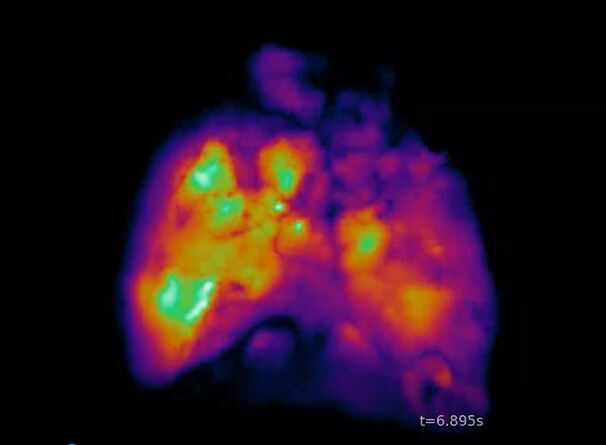 These Mice Have Partly Human Brains
