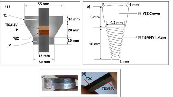 Bi-layered single-piece dental implant reduces the need for surgical interventions